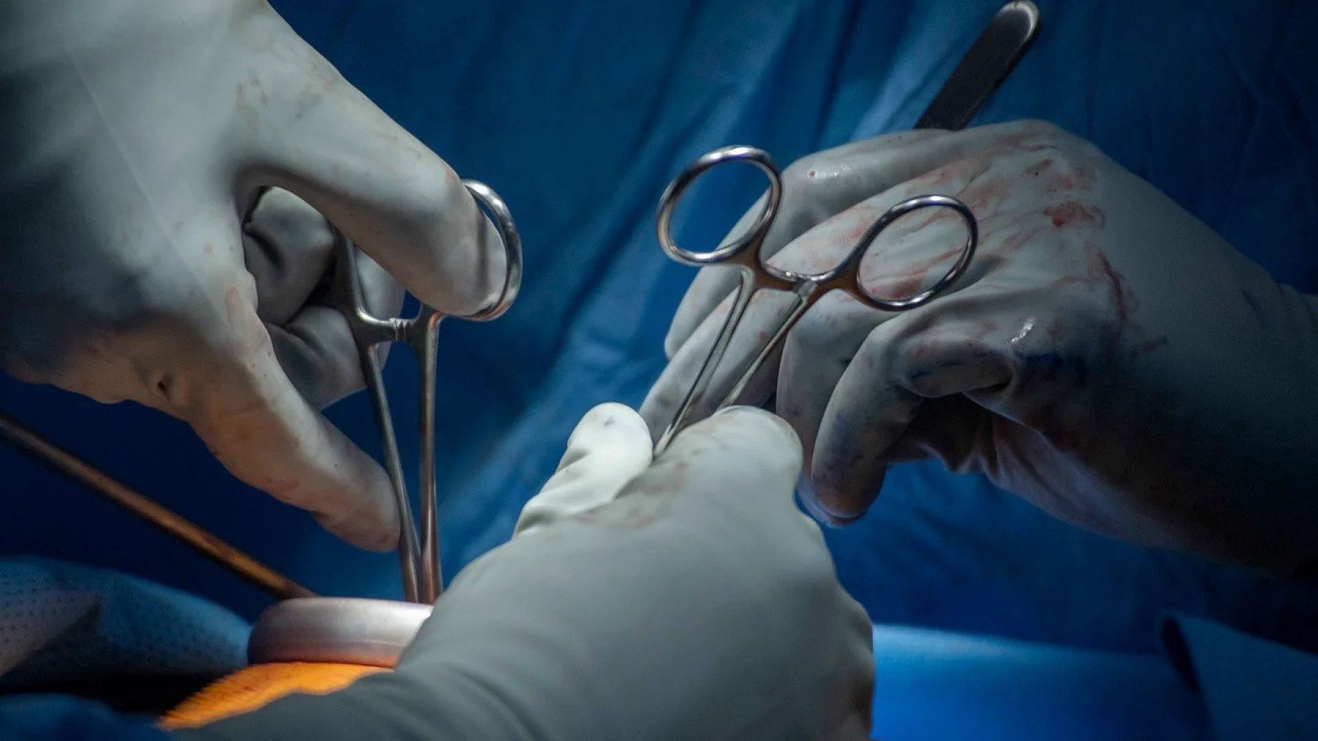 A military surgeon performs an emergency appendectomy as other medical team members assist. (Mass Communication Specialist 1st Class Andrew Brame/U.S. Navy).